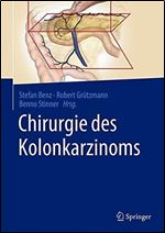 Chirurgie des Kolonkarzinoms [German]